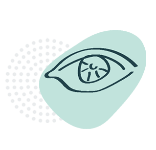 Retinoblastoma_kropki